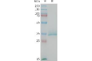 Mouse CGRP Protein, hFc Tag on SDS-PAGE under reducing condition. (CGRP Protein (AA 83-119) (Fc Tag))