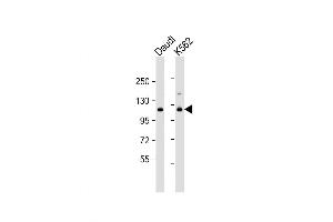 Western Blot at 1:1000 dilution Lane 1: Daudi whole cell lysate Lane 2: K562 whole cell lysate Lysates/proteins at 20 ug per lane. (STAT2 Antikörper  (C-Term))