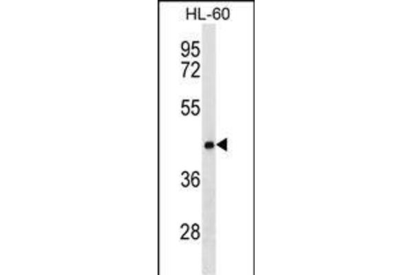 CLN8 Antikörper  (C-Term)