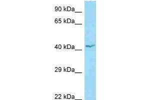 WB Suggested Anti-APOL1 Antibody Titration: 1. (APOL1 Antikörper  (N-Term))