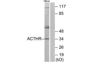 Western blot analysis of extracts from HeLa cells, using ACTHR antibody. (MC2R Antikörper  (C-Term))