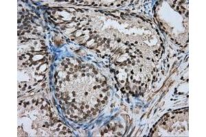 Immunohistochemical staining of paraffin-embedded pancreas tissue using anti-DAPK2 mouse monoclonal antibody. (DAPK2 Antikörper)