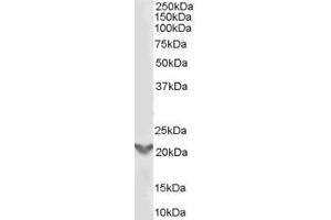 Western Blotting (WB) image for anti-TGFB-Induced Factor Homeobox 2 (TGIF2) (Internal Region) antibody (ABIN2466365) (TGIF2 Antikörper  (Internal Region))