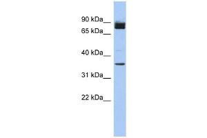 MGC48628 antibody used at 1 ug/ml to detect target protein. (MGC48628 (N-Term) Antikörper)