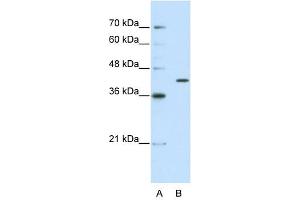 THEX1 antibody used at 2. (ERI1 Antikörper  (C-Term))