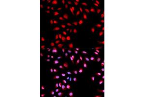 Immunofluorescence analysis of U2OS cells using Phospho-MET-Y1003 antibody (ABIN5969921). (c-MET Antikörper  (pTyr1003))