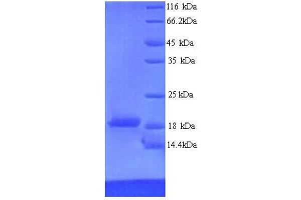 RAVER2 Protein (AA 1-140, partial) (His tag)