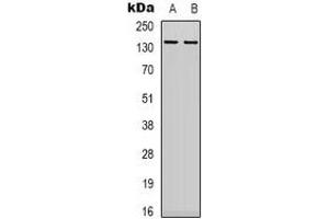 Western blot analysis of DNA Ligase 1 expression in 22RV1 (A), MCF7 (B) whole cell lysates. (LIG1 Antikörper  (N-Term))