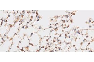Immunohistochemistry of paraffin-embedded Mouse brain using TRIP4 Polyclonal Antibody at dilution of 1:50 (TRIP4 Antikörper)