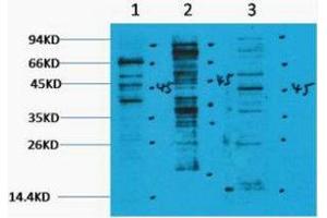 Western Blotting (WB) image for anti-Methylated Lysine (pan) antibody (ABIN3181295) (Methylated Lysine (pan) Antikörper)