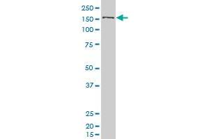 SMC1L1 polyclonal antibody (A01), Lot # 051003JC01 Western Blot analysis of SMC1L1 expression in 293 . (SMC1A Antikörper  (AA 366-465))