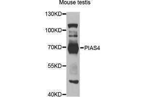 Western blot analysis of extracts of mouse testis, using PIAS4 antibody (ABIN5975368) at 1/1000 dilution. (PIAS4 Antikörper)