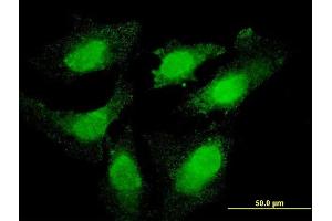 Immunofluorescence of monoclonal antibody to TOP3B on HeLa cell. (TOP3B Antikörper  (AA 1-862))