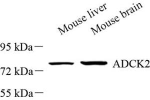 Western blot analysis of ADCK2 (ABIN7072872) at dilution of 1: 500 (ADCK2 Antikörper)