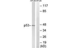 Western blot analysis of extracts from HT-29 cells, treated with calyculinA 50ng/ml 30', using p53 (Ab-376) Antibody. (p53 Antikörper  (AA 334-383))