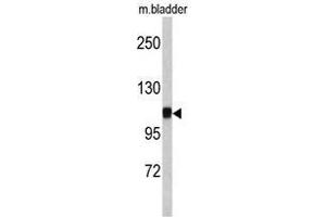 Image no. 1 for anti-Catenin (Cadherin-Associated Protein), alpha 1, 102kDa (CTNNA1) (N-Term) antibody (ABIN452886) (CTNNA1 Antikörper  (N-Term))