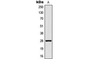 Western blot analysis of CD90 expression in MCF7 (A) whole cell lysates. (CD90 Antikörper  (Center))