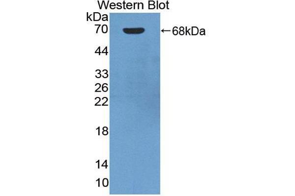 Angiostatin Antikörper  (AA 100-434)