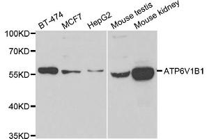 Western blot analysis of extracts of various cell lines, using ATP6V1B1 antibody (ABIN5975742) at 1/1000 dilution. (ATP6V1B1 Antikörper)