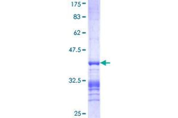 Ephrin B1 Protein (EFNB1) (AA 118-217) (GST tag)