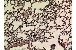 Immunohistochemical analysis of paraffin-embedded mouse-lung, antibody was diluted at 1:100. (NRF2 Antikörper  (acLys599))