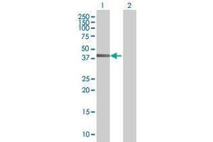 Lane 1: ZBTB37 transfected lysate ( 39. (ZBTB37 293T Cell Transient Overexpression Lysate(Denatured))
