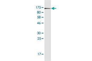 Western Blot detection against Immunogen (102. (CD44 Antikörper  (AA 1-699))