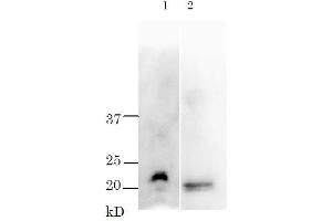 Western Blotting (WB) image for anti-TRH Toxin antibody (ABIN2452158)