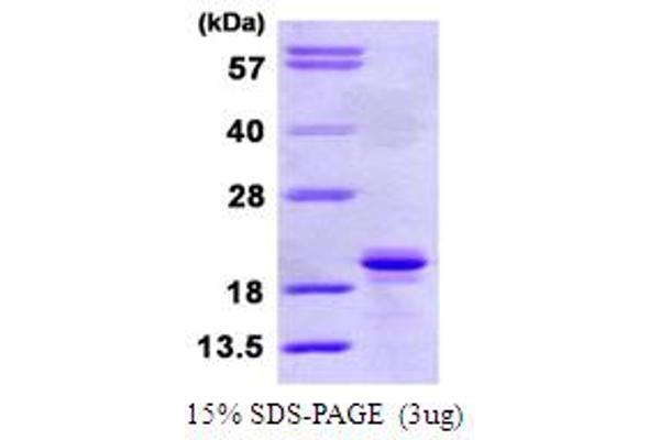 SIT1 Protein (AA 1-196) (His tag)