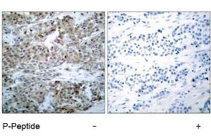 Image no. 1 for anti-BCL2-Associated Agonist of Cell Death (BAD) (pSer112), (pSer75) antibody (ABIN196735) (BAD Antikörper  (pSer75, pSer112))