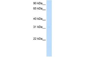 MLF2 antibody used at 5 ug/ml to detect target protein. (MLF2 Antikörper  (Middle Region))