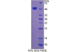 SDS-PAGE analysis of Human Integrin beta 1 Protein. (ITGB1 Protein)