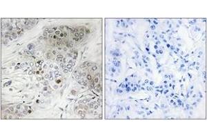 Immunohistochemistry (IHC) image for anti-Tumor Protein P53 (TP53) (pSer9) antibody (ABIN2888503) (p53 Antikörper  (pSer9))