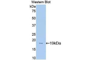 Western blot analysis of recombinant Mouse MK. (Midkine Antikörper  (AA 22-140))