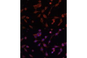 Immunofluorescence analysis of NIH/3T3 cells using L antibody (ABIN6130048, ABIN6143079, ABIN6143080 and ABIN6215226) at dilution of 1:100. (LAMP1 Antikörper  (AA 80-280))