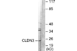 Western blot analysis of extracts from HuvEc cells, using Claudin 3 antibody. (Claudin 3 Antikörper)
