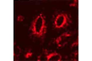 Image no. 1 for anti-Lysosomal-Associated Membrane Protein 1 (LAMP1) antibody (ABIN466916) (LAMP1 Antikörper)