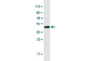 Western Blot detection against Immunogen (36. (FOXD4L1 Antikörper  (AA 285-384))