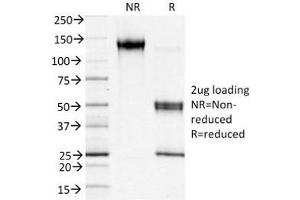 SDS-PAGE (SDS) image for anti-S100 Calcium Binding Protein A4 (S100A4) antibody (ABIN4949868)