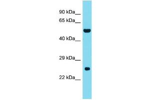 Host: Rabbit Target Name: DNAAF3 Sample Type: Fetal Liver lysates Antibody Dilution: 1. (DNAAF3 Antikörper  (C-Term))