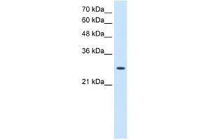 AK2 antibody used at 2. (Adenylate Kinase 2 Antikörper  (N-Term))