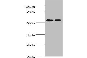 Western blot All lanes: CDK16 antibody at 5 μg/mL Lane 1: Mouse brain tissue Lane 2: Mouse small intestineSecondary Goat polyclonal to rabbit IgG at 1/10000 dilution Predicted band size: 56, 64, 57 kDa Observed band size: 56 kDa (CDK16 Antikörper  (AA 277-496))