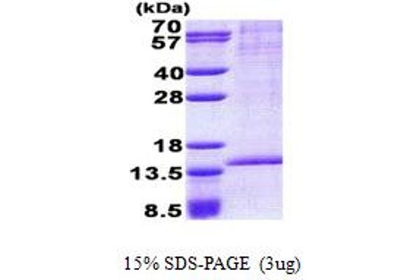 RAB8B Protein (AA 1-204) (His tag)