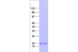 Validation with Western Blot (Caveolin 2 Protein (CAV2) (His tag))