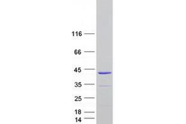 TNNT3 Protein (Transcript Variant 3) (Myc-DYKDDDDK Tag)