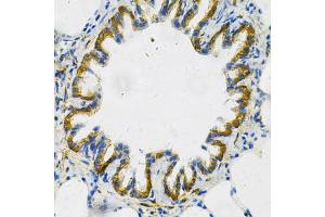 Immunohistochemistry of paraffin-embedded rat lung using AK1 Antibody. (Adenylate Kinase 1 Antikörper)