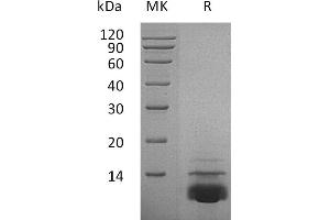 Greater than 95 % as determined by reducing SDS-PAGE. (CXCL5 Protein)