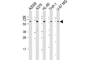 Western Blotting (WB) image for anti-CD63 (CD63) (AA 163-190), (C-Term) antibody (ABIN651526)