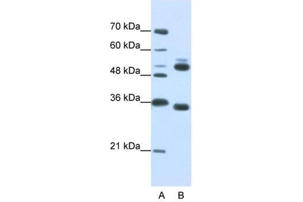 WDR6 Antikörper  (C-Term)