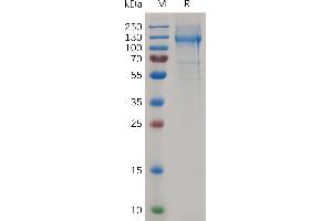 Mouse NCL Protein, His Tag on SDS-PAGE under reducing condition. (Nucleolin Protein (NCL) (AA 2-707) (His tag))